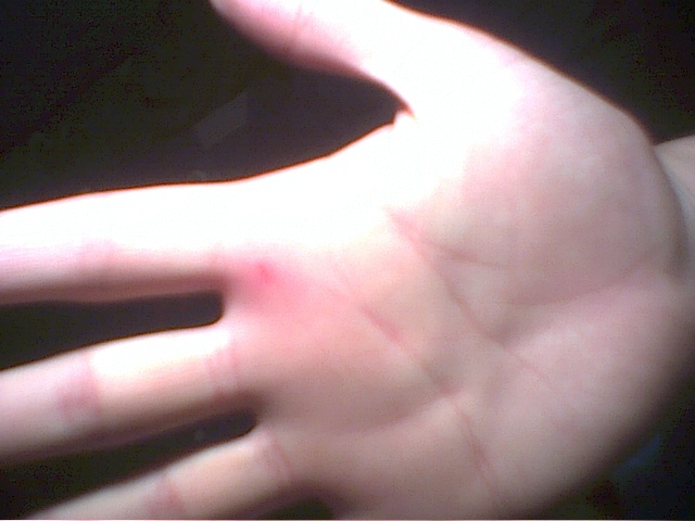 Der riesige rote Schnitt da...